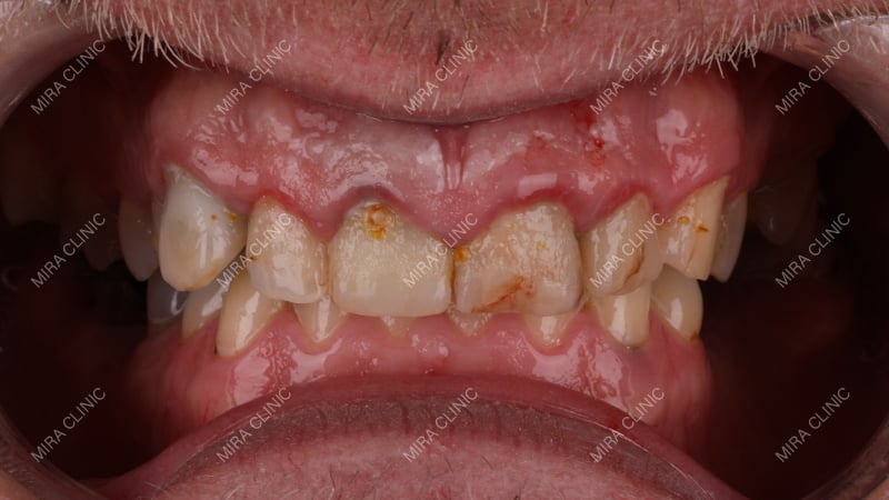 Dental Problems